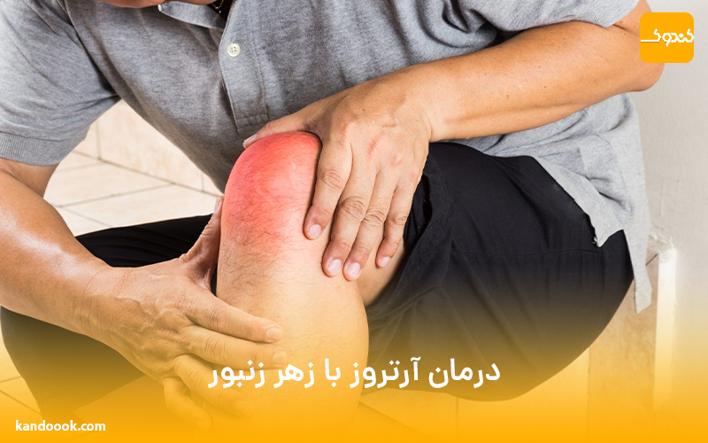 درمان آرتروز با زهر زنبور !