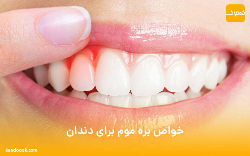خواص بره موم برای دندان