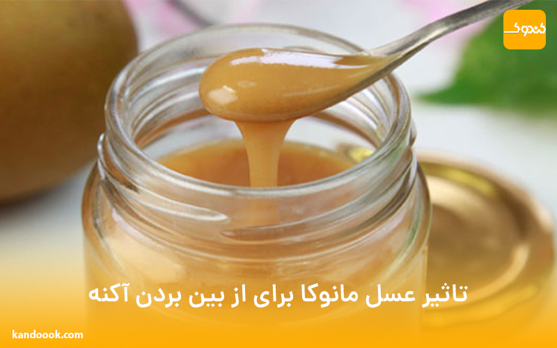 تاثیر عسل مانوکا برای از بین بردن آکنه