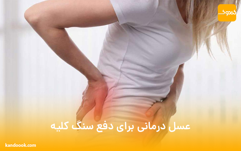 عسل، درمانی برای دفع سنگ کلیه