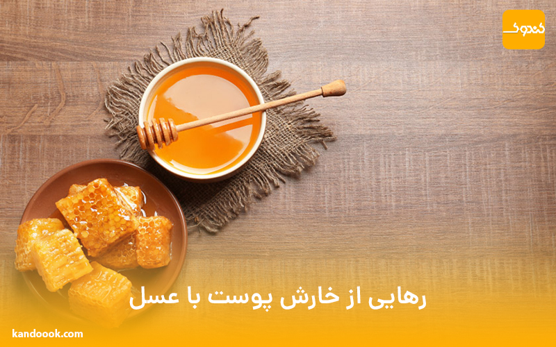 رهایی از خارش پوست با عسل