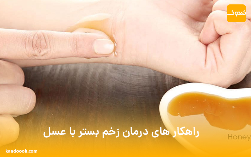 راهکار های درمان زخم بستر با عسل