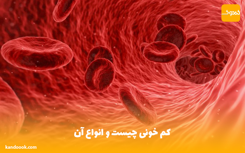 کم خونی چیست و انواع آن
