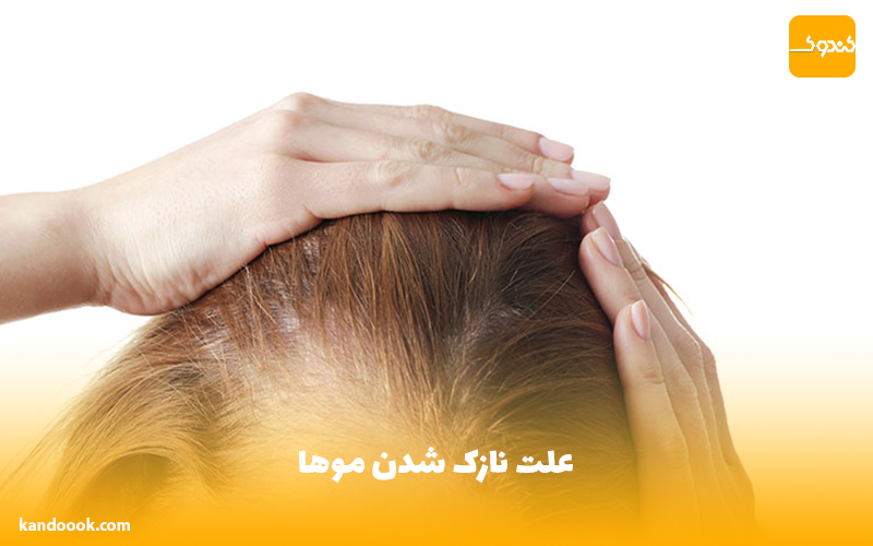 علت نازک شدن موها