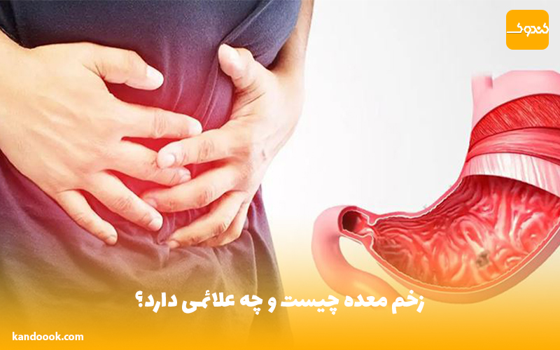 زخم معده چیست و چه علائمی دارد؟