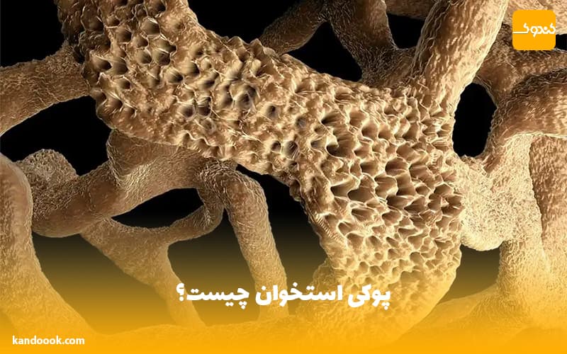 پوکی استخوان چیست ؟