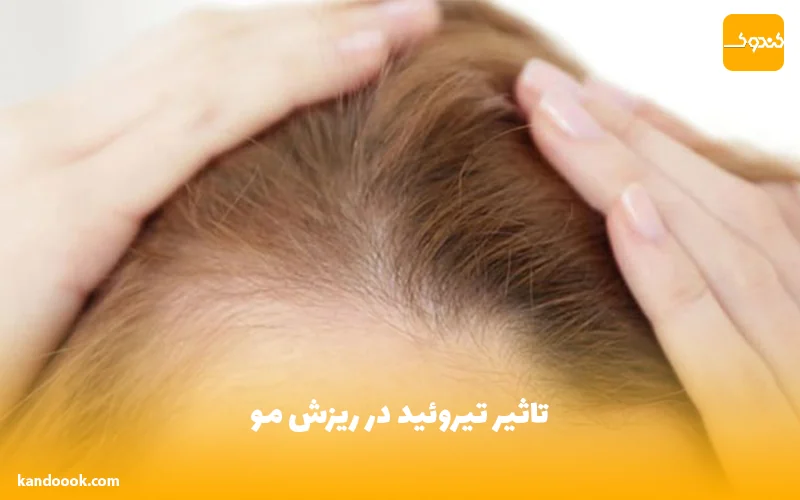 تاثیر تیروئید در ریزش مو