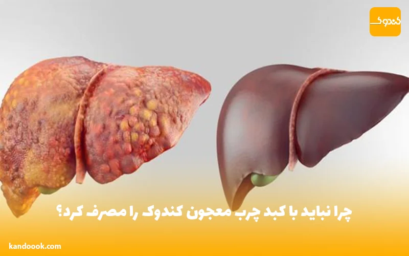 چرا نباید با کبد چرب معجون کندوک را مصرف کرد؟