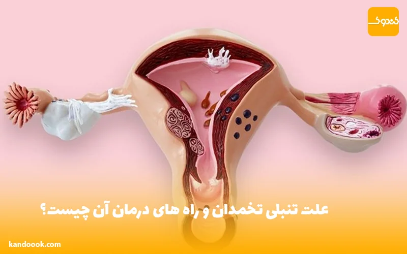 علت تنبلی تخمدان و راه های درمان آن چیست؟