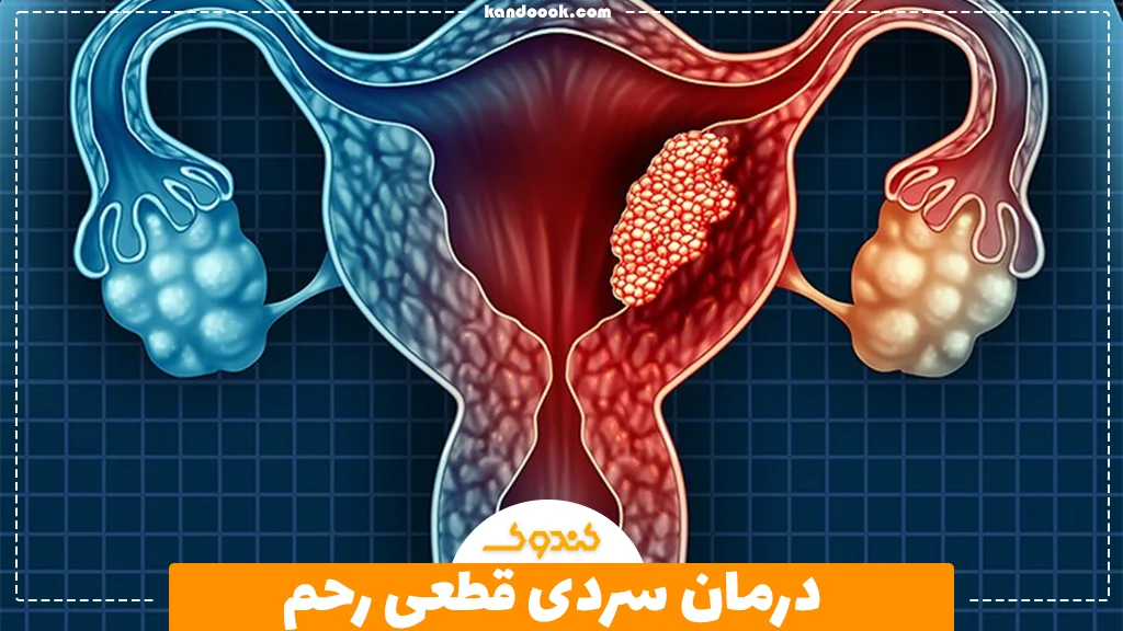 درمان سردی قطعی رحم + راهکاری مطمئن برای درمان سردی رحم