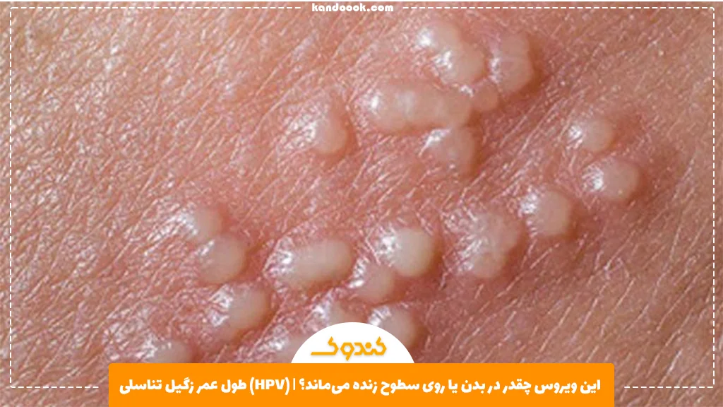 طول عمر زگیل تناسلی (HPV) | این ویروس چقدر در بدن یا روی سطوح زنده می‌ماند؟