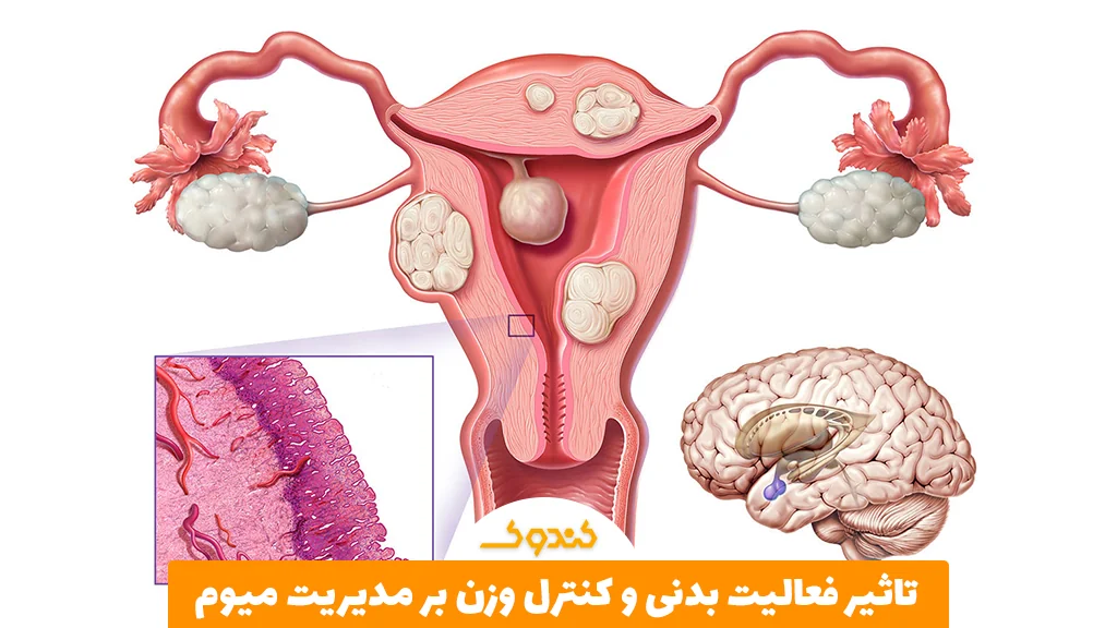 تاثیر فعالیت بدنی و کنترل وزن بر مدیریت میوم