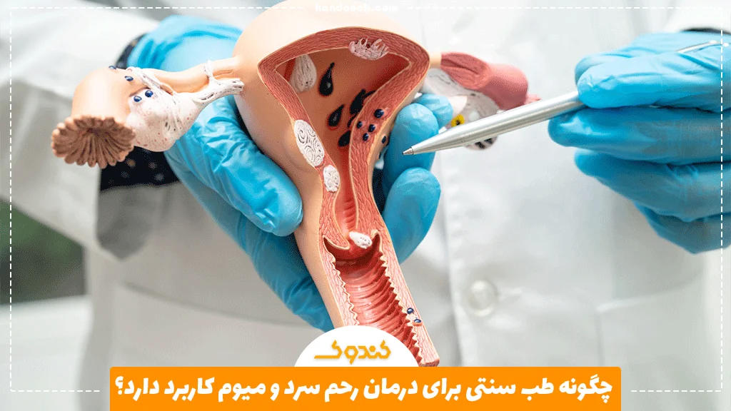 چگونه طب سنتی برای درمان رحم سرد و میوم کاربرد دارد؟